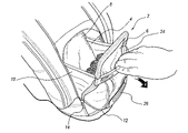 US-7111731-B2 figure 1