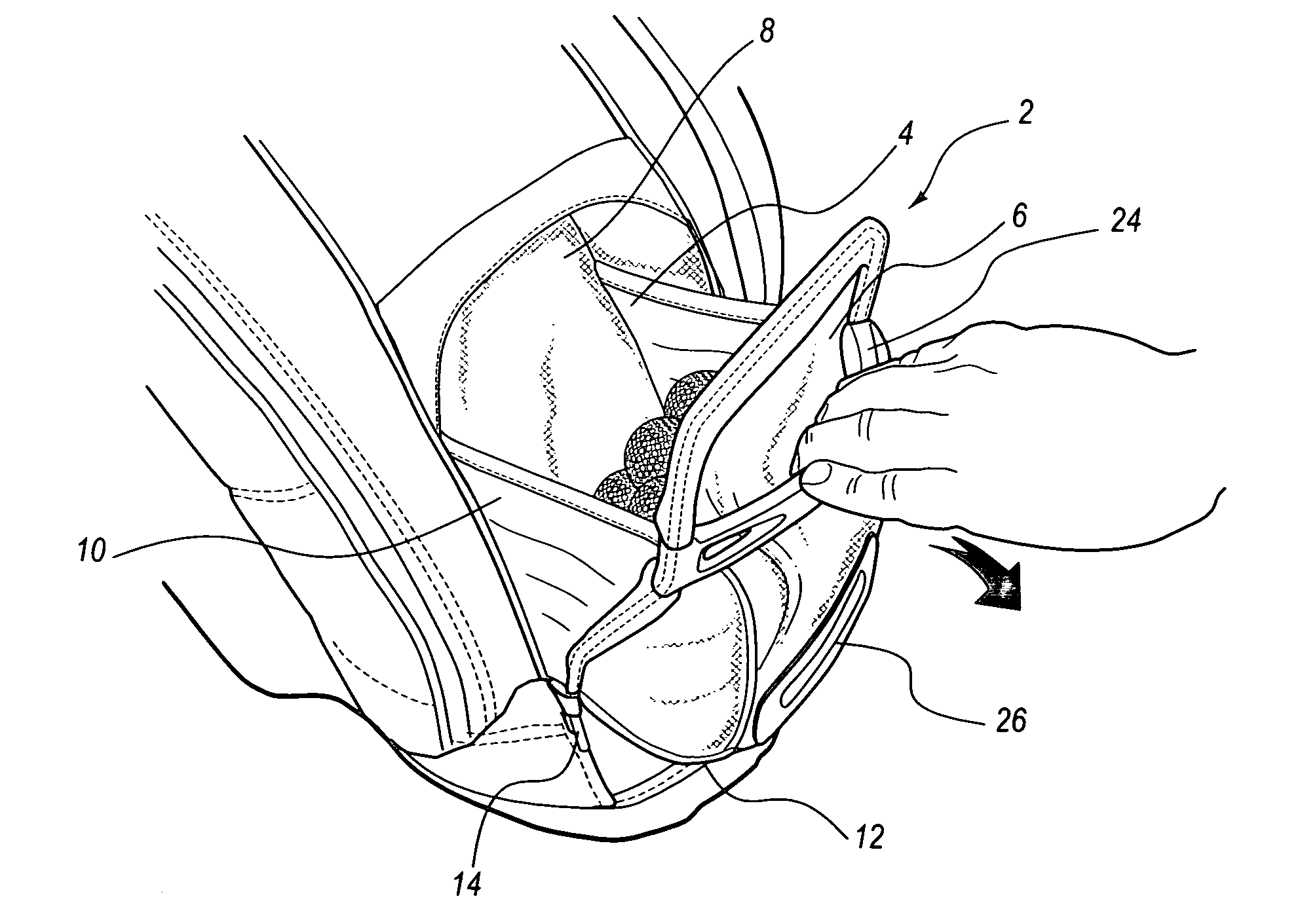 US-7111731-B2 figure 2