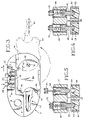 US-7127922-B2 figure 5