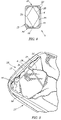 US-7195109-B2 figure 5