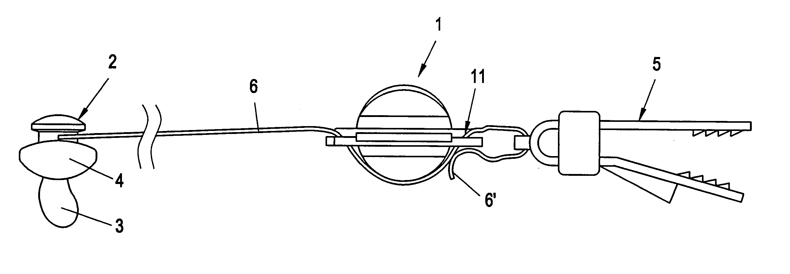 US-7204845-B2 figure 2