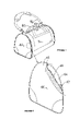 US-7207426-B2 figure 3