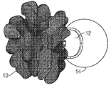 US-7318682-B2 figure 1