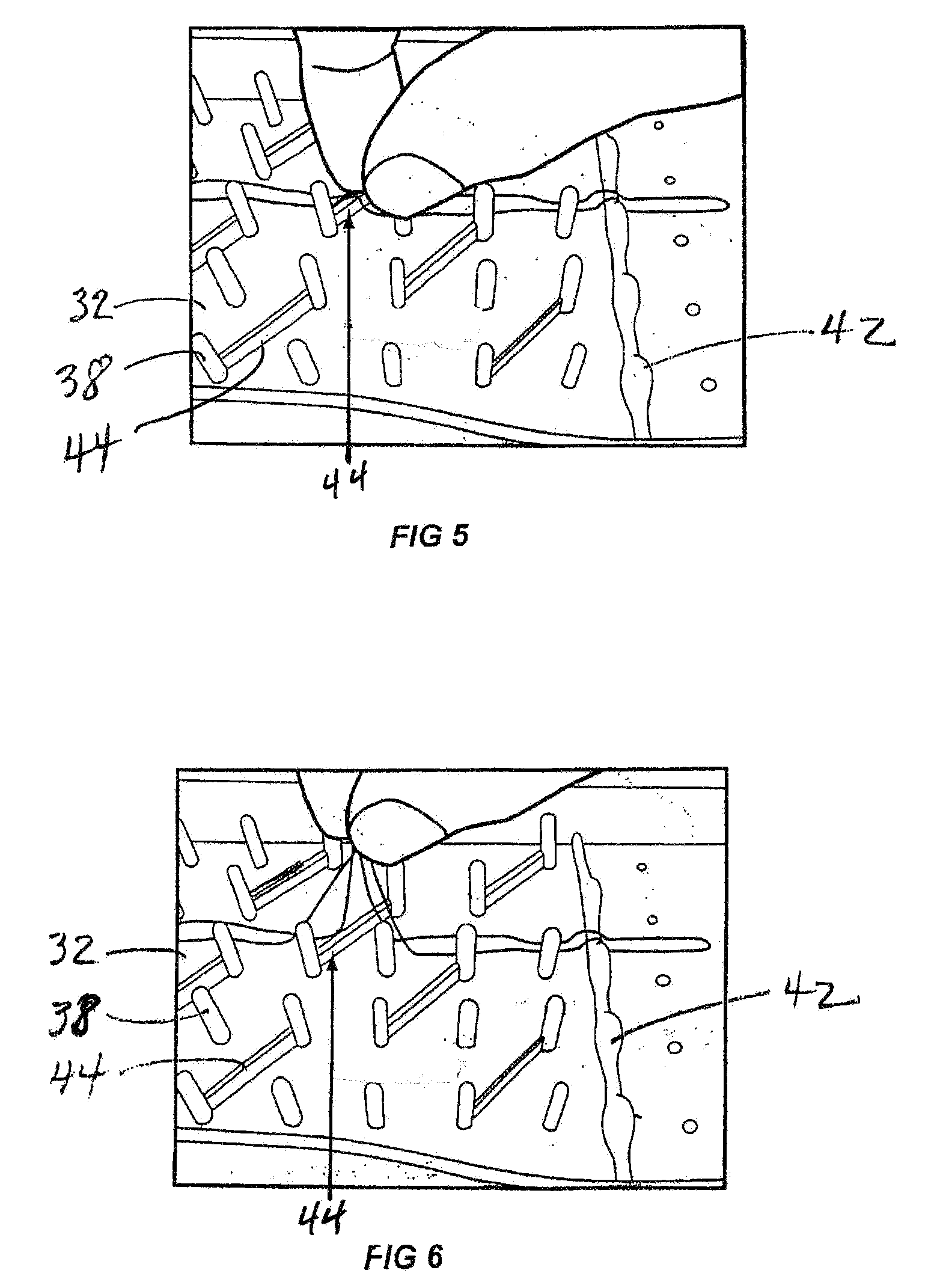 US-7367449-B2 figure 8