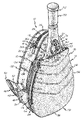 US-7395930-B2 figure 1