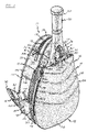 US-7395930-B2 figure 3
