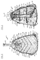 US-7395930-B2 figure 5