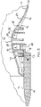 US-7430769-B2 figure 7