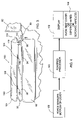 US-7437781-B2 figure 5