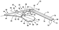 US-7438002-B2 figure 1
