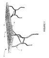 US-7469646-B2 figure 3