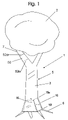 US-7469797-B2 figure 3