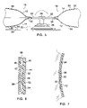 US-7472449-B2 figure 5