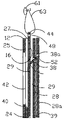US-7475507-B2 figure 1