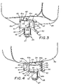 US-7503465-B2 figure 7
