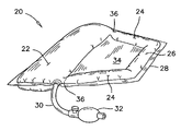 US-7513002-B2 figure 1
