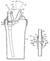 US-7516862-B2 figure 1