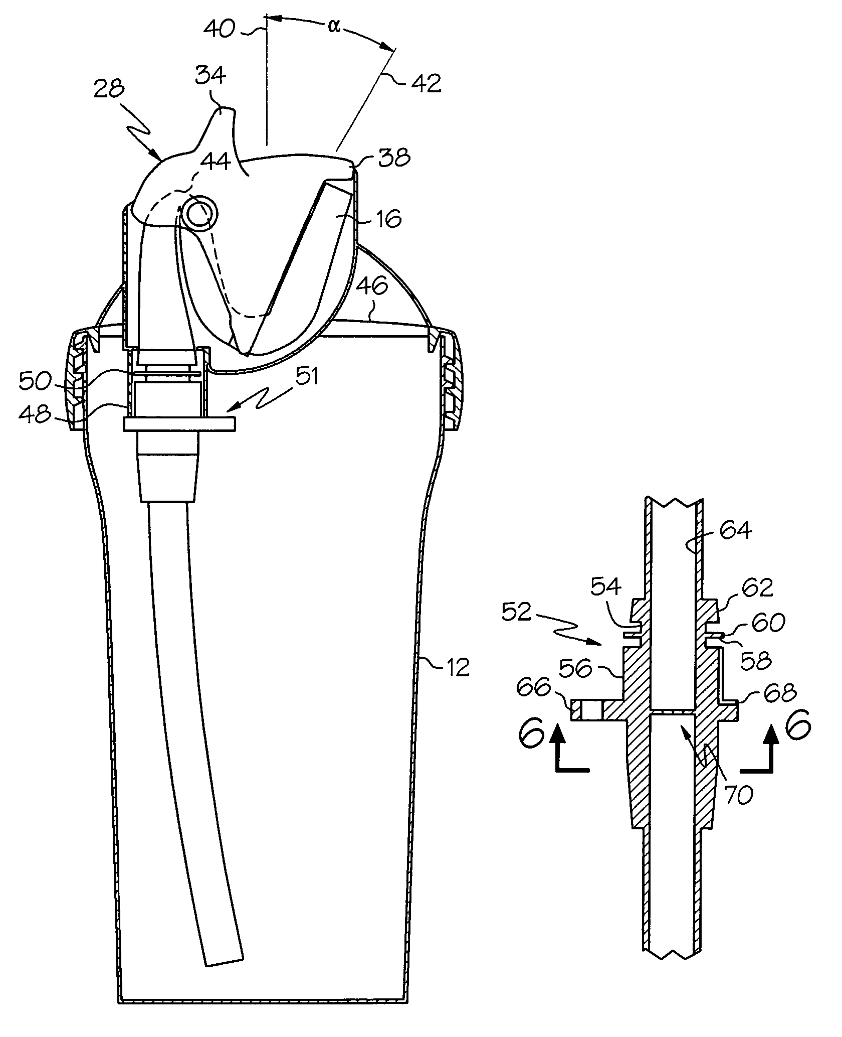 US-7516862-B2 figure 2