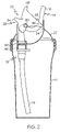 US-7516862-B2 figure 5