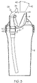 US-7516862-B2 figure 7