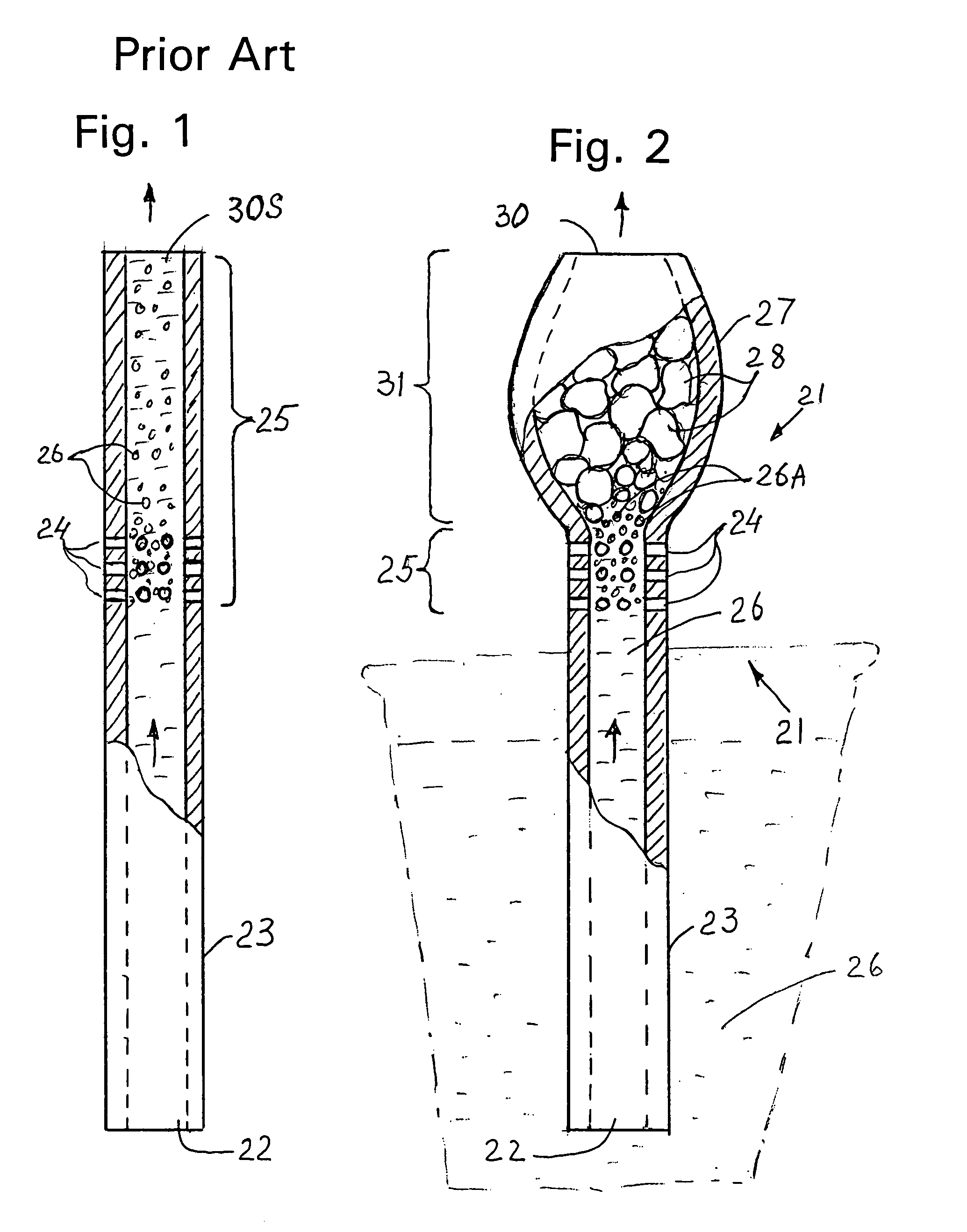US-7537173-B1 figure 4