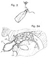 US-7537173-B1 figure 7