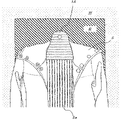 US-7552850-B2 figure 1