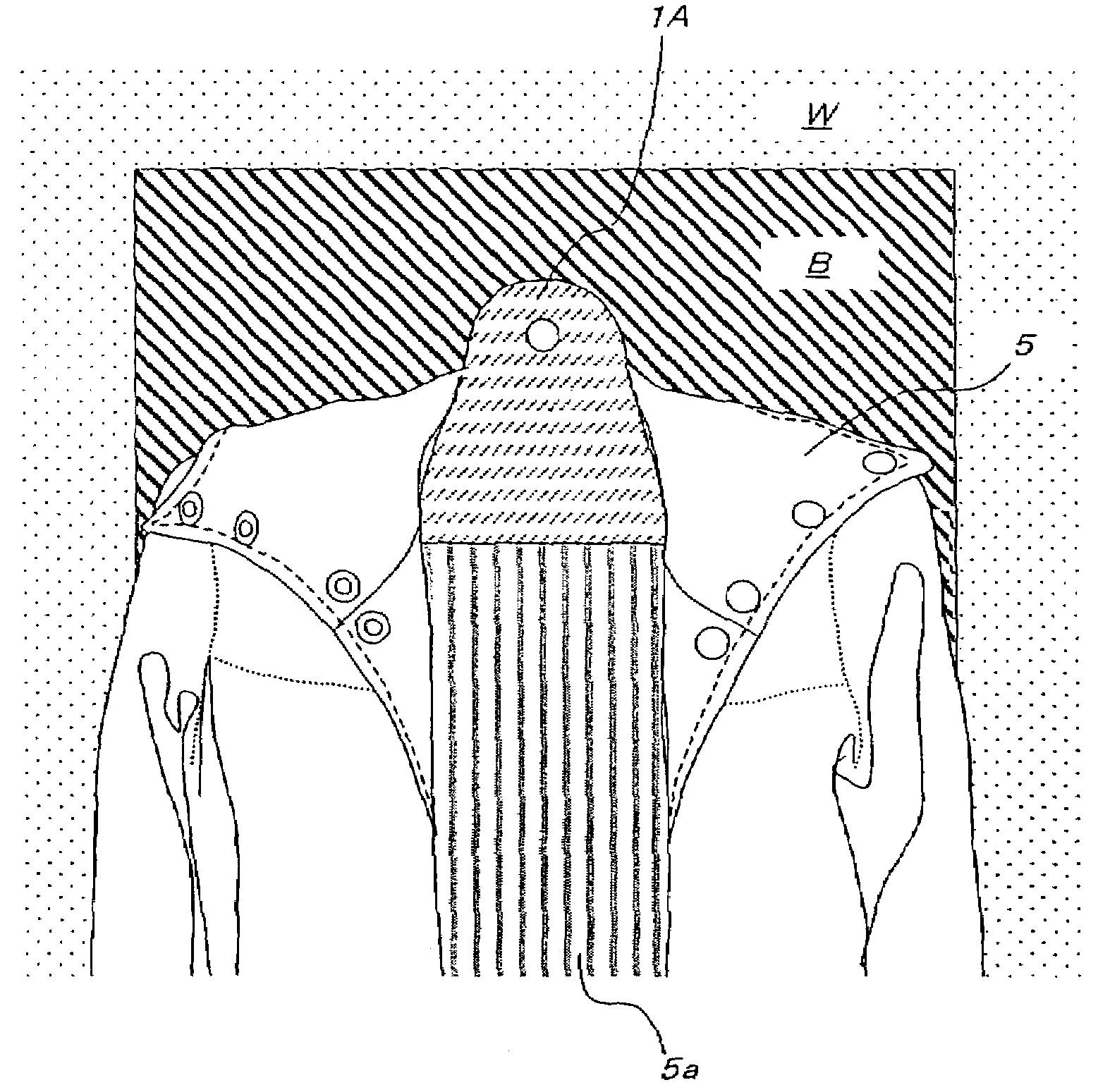 US-7552850-B2 figure 2