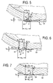 US-7575127-B2 figure 7