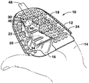 US-7575384-B2 figure 1