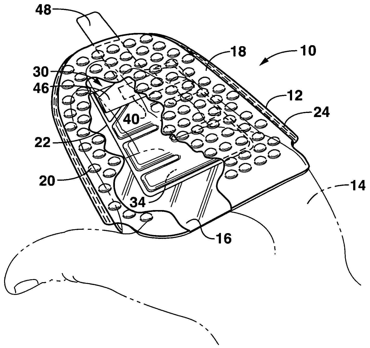 US-7575384-B2 figure 2