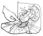US-7588197-B2 figure 1