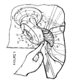 US-7588197-B2 figure 3