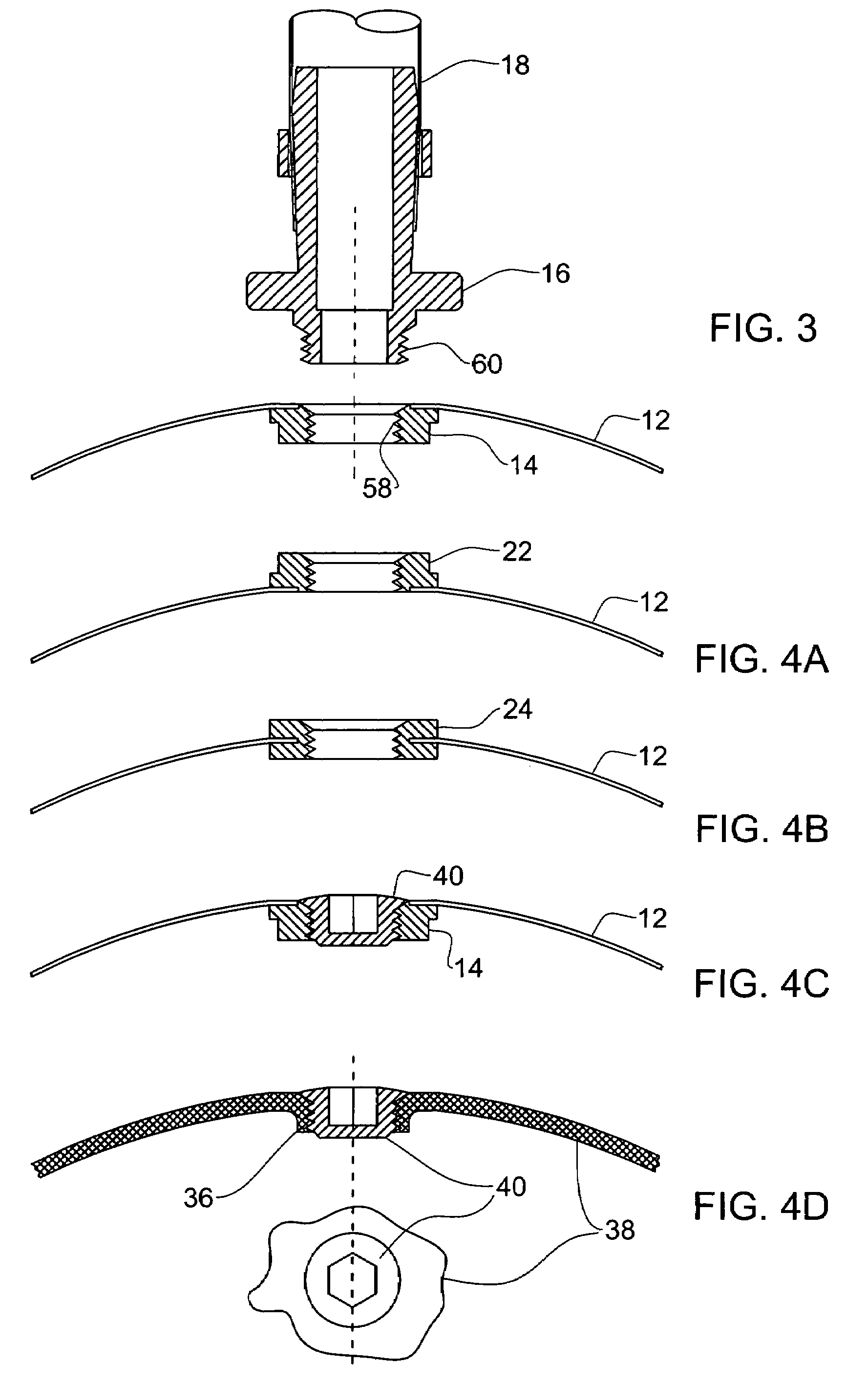 US-7588201-B2 figure 6