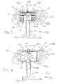 US-7617952-B2 figure 7