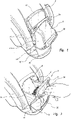US-7628188-B2 figure 3