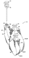 US-7665634-B2 figure 1