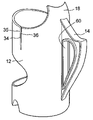 US-7726499-B2 figure 1