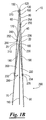 US-7726622-B2 figure 5