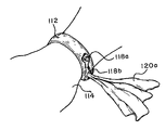 US-7735682-B1 figure 1