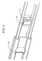 US-7744176-B2 figure 7