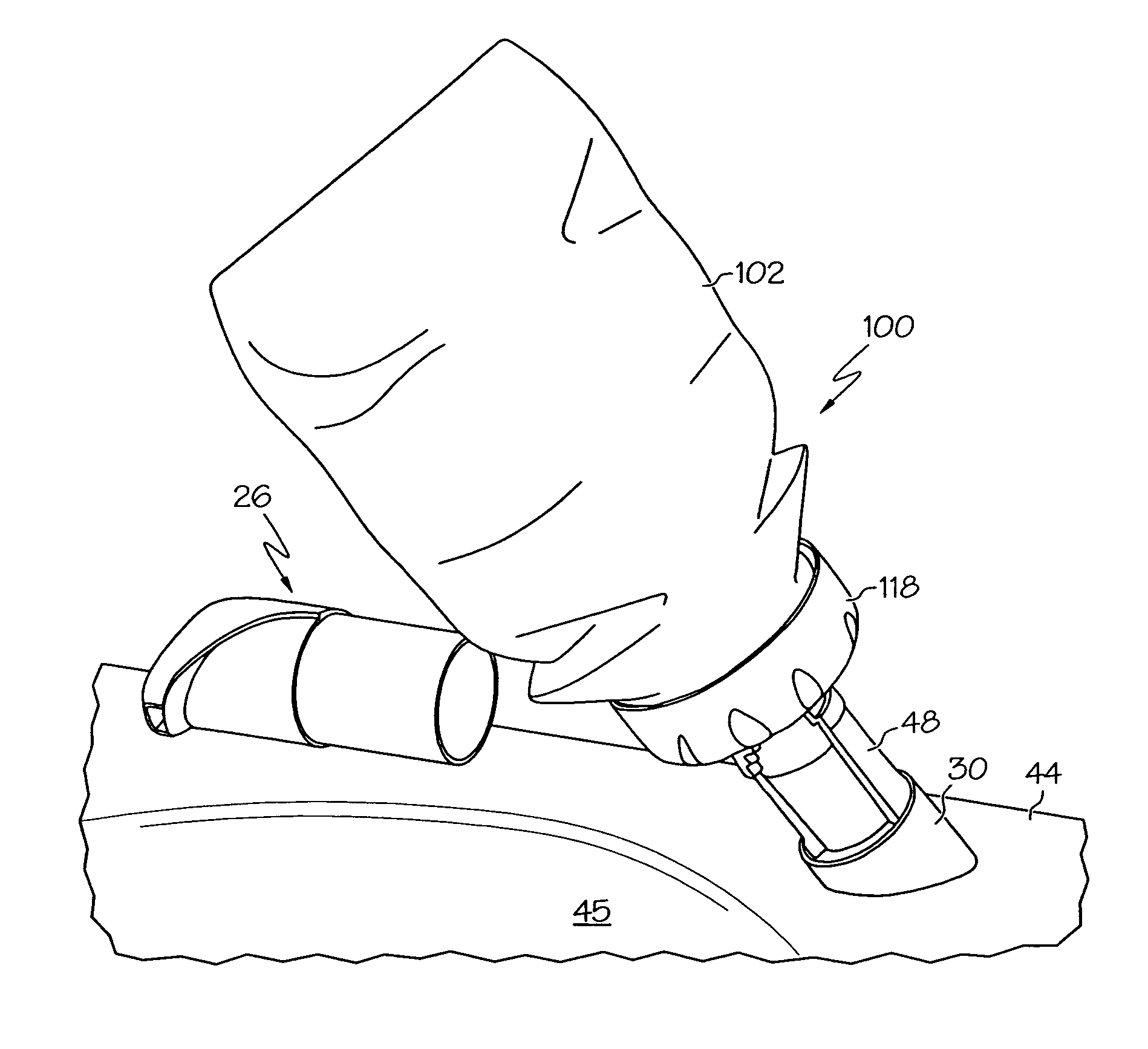 US-7753087-B2 figure 2
