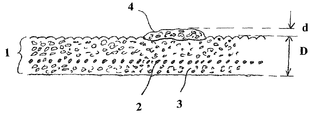 US-7776431-B2 figure 1