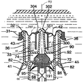 US-7815076-B2 figure 1