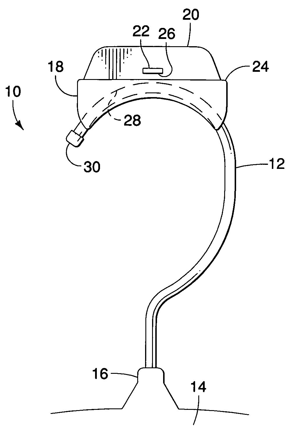 US-7841495-B2 figure 2