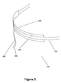 US-7927321-B2 figure 7