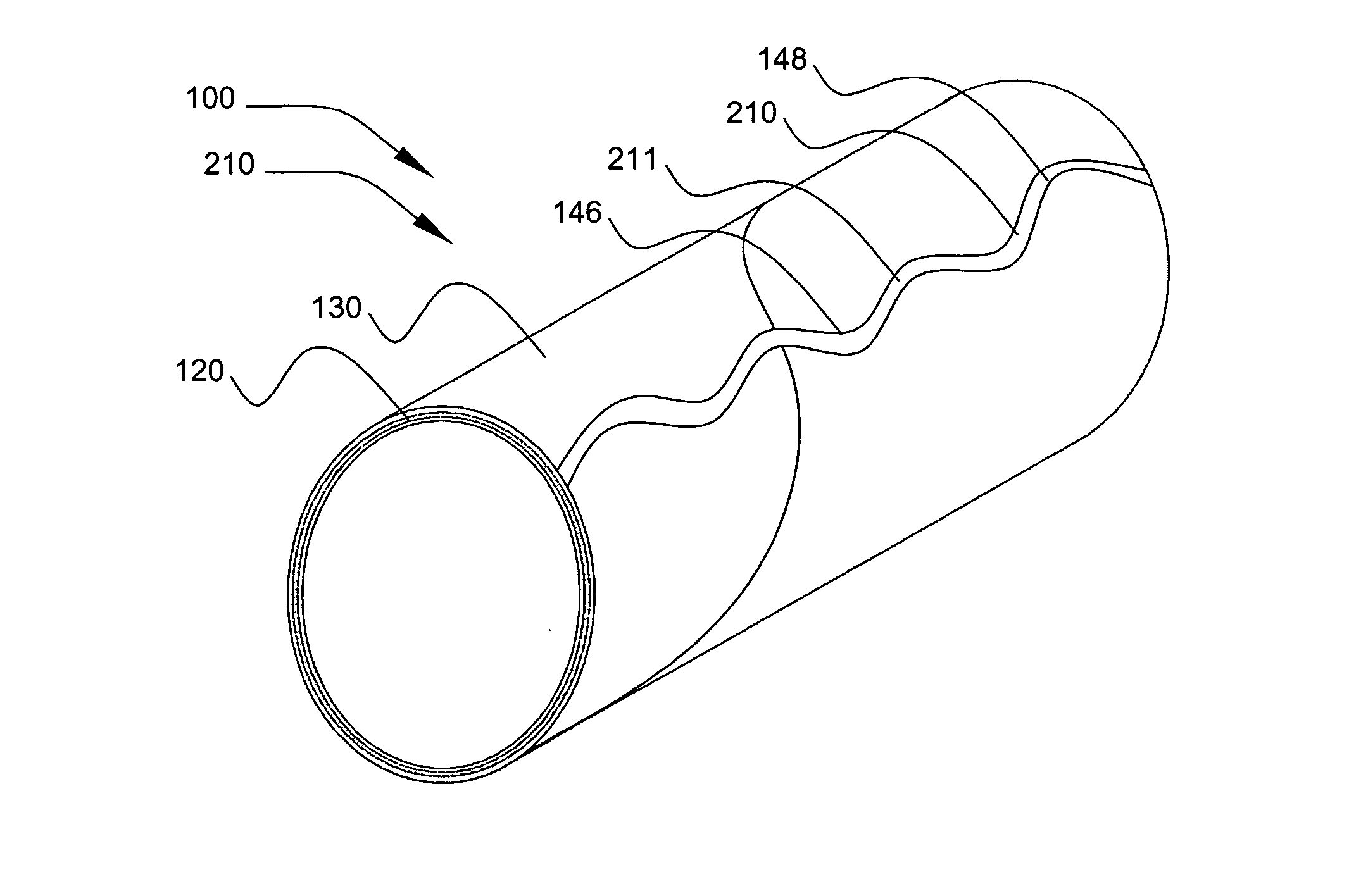 US-7951440-B2 figure 2
