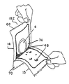 US-7967133-B2 fig 1