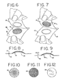 US-7967133-B2 fig 5