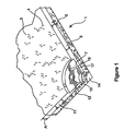US-7980040-B2 figure 3